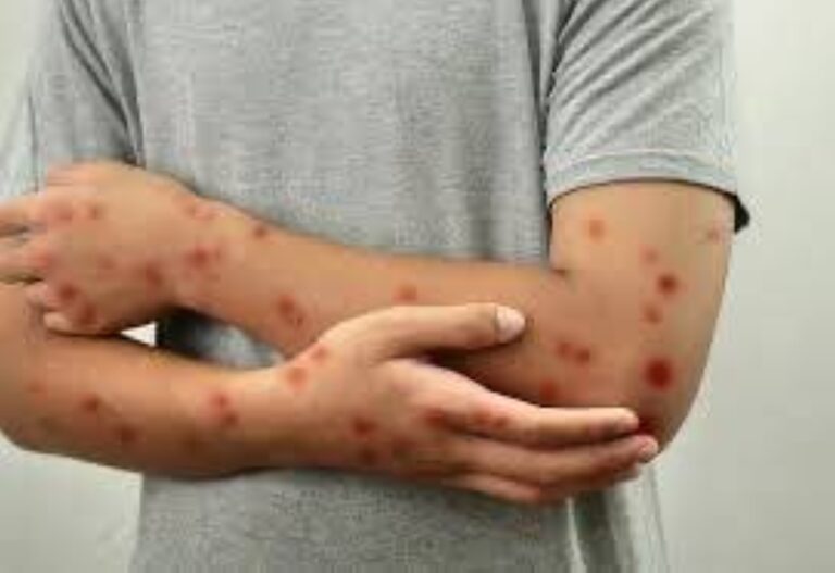 %d8%a7%d9%84%d8%ad%d8%b5%d8%a8%d8%a9 %d8%aa%d8%b6%d8%b1%d8%a8 %d8%aa%d9%83%d8%b3%d8%a7%d8%b3 %d9%88%d8%aa%d8%ad%d8%b1%d9%83%d8%a7%d8%aa %d8%b9%d8%a7%d8%ac%d9%84%d8%a9 %d9%84%d8%a7%d8%ad