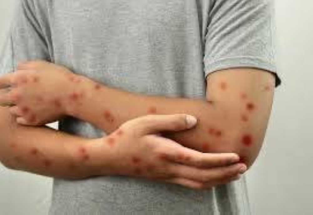 %d8%a7%d9%84%d8%ad%d8%b5%d8%a8%d8%a9 %d8%aa%d8%b6%d8%b1%d8%a8 %d8%aa%d9%83%d8%b3%d8%a7%d8%b3 %d9%88%d8%aa%d8%ad%d8%b1%d9%83%d8%a7%d8%aa %d8%b9%d8%a7%d8%ac%d9%84%d8%a9 %d9%84%d8%a7%d8%ad