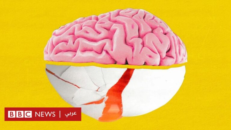 %d8%af%d8%b1%d8%a7%d8%b3%d8%a7%d8%aa %d8%a7%d9%84%d8%a8%d9%8a%d8%b6 %d8%ae%d9%8a%d8%a7%d8%b1 %d9%85%d8%ab%d8%a7%d9%84%d9%8a %d9%84%d8%a3%d8%ad%d8%af %d8%a7%d9%84%d8%b9%d9%86%d8%a7%d8%b5%d8%b1 %d8%a7