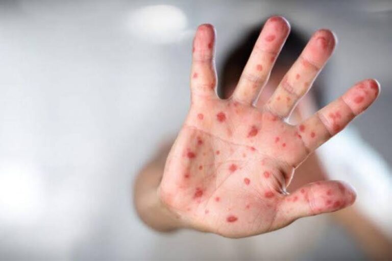 %d9%85%d9%86 %d9%84%d9%86%d8%af%d9%86 %d8%a5%d9%84%d9%89 %d8%aa%d9%84 %d8%a3%d8%a8%d9%8a%d8%a8 %d8%a7%d9%84%d8%ad%d8%b5%d8%a8%d8%a9 %d8%aa%d8%b6%d8%b1%d8%a8 %d9%82%d9%84%d8%a8 %d8%a5