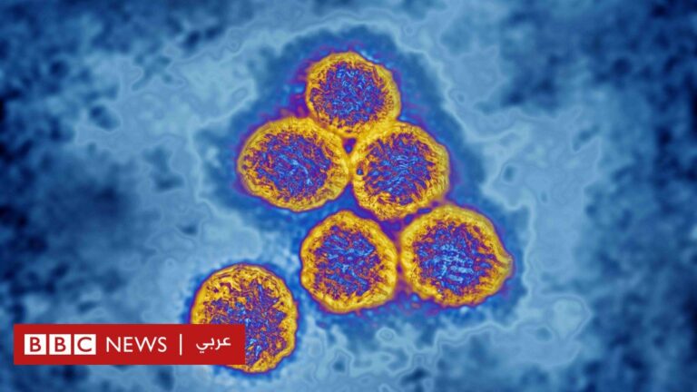 %d8%a7%d9%84%d8%ad%d9%85%d8%a9 %d8%a7%d9%84%d9%86%d8%b2%d9%81%d9%8a%d8%a9 %d8%a8%d8%b9%d8%af %d8%aa%d8%b3%d8%ac%d9%8a%d9%84 %d8%a5%d8%b5%d8%a7%d8%a8%d8%a7%d8%aa %d8%ac%d8%af%d9%8a%d8%af%d8%a9 %d9%81