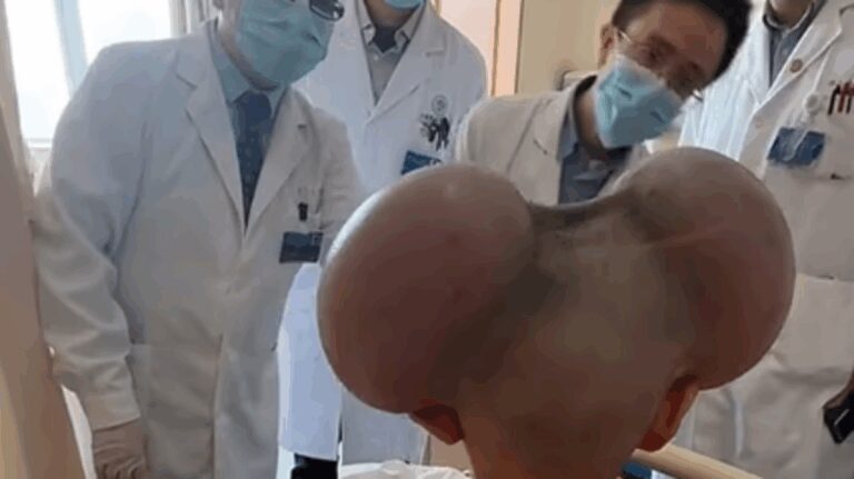 %d8%aa%d8%b9%d8%b1%d8%b6 %d9%84%d9%84%d8%aa%d9%86%d9%85%d8%b1 %d9%88%d9%84%d9%82%d8%a8 %d8%a8%d9%80%d9%85%d9%8a%d9%83%d9%8a %d9%85%d8%a7%d9%88%d8%b3 %d8%b9%d8%a7%d8%a6%d9%84%d8%a9 %d8%a7%d9%84