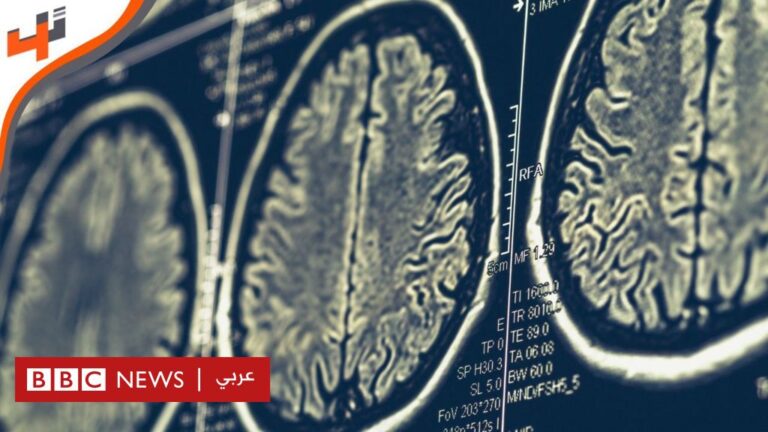 %d8%a7%d8%b3%d8%aa%d9%86%d8%a8%d8%a7%d8%aa %d8%ae%d9%84%d8%a7%d9%8a%d8%a7 %d8%af%d9%85%d8%a7%d8%ba %d9%85%d9%86 %d8%a3%d8%b9%d8%b6%d8%a7%d8%a1 %d8%a7%d9%84%d8%ac%d8%b3%d9%85