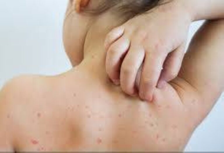 %d8%a7%d9%84%d8%ad%d8%b5%d8%a8%d8%a9 %d8%aa%d8%b6%d8%b1%d8%a8 %d8%a8%d9%82%d9%88%d8%a9 10 %d9%88%d9%84%d8%a7%d9%8a%d8%a7%d8%aa %d8%a3%d9%85%d8%b1%d9%8a%d9%83%d9%8a%d8%a9 %d8%aa%d8%ad%d8%aa %d9%88