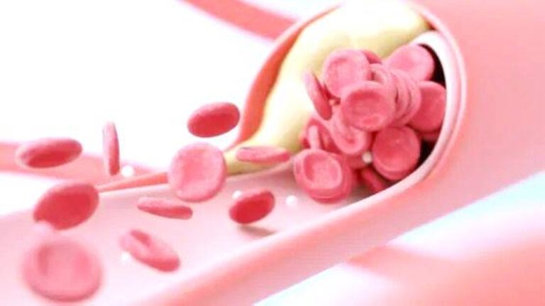 %d9%87%d9%84 %d9%8a%d8%ad%d8%aa%d8%a7%d8%ac %d8%a7%d9%84%d9%85%d8%b5%d8%a7%d8%a8%d9%88%d9%86 %d8%a8%d8%b6%d9%8a%d9%82 %d9%81%d9%8a %d8%b4%d8%b1%d8%a7%d9%8a%d9%8a%d9%86 %d8%a7%d9%84%d8%b1%d9%82%d8%a8