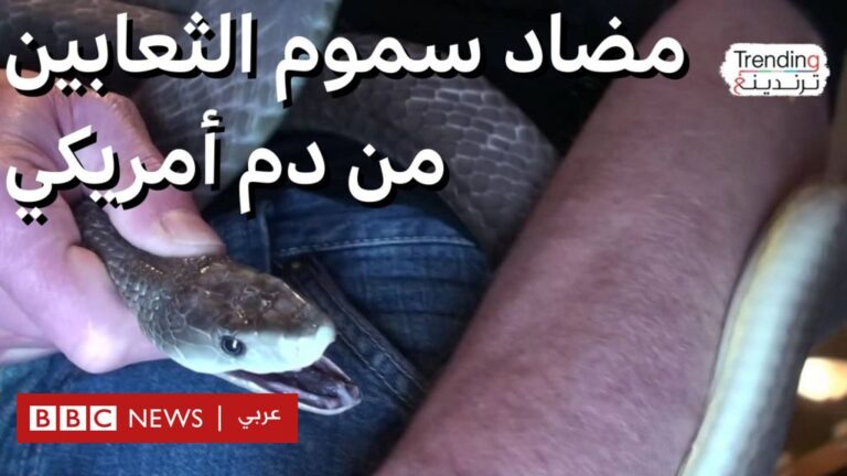 %d9%83%d9%8a%d9%81 %d8%a7%d8%b3%d8%aa%d9%81%d8%a7%d8%af %d8%a7%d9%84%d8%b9%d9%84%d9%85%d8%a7%d8%a1 %d9%85%d9%86 %d8%af%d9%85 %d8%a3%d9%85%d8%b1%d9%8a%d9%83%d9%8a %d8%ad%d9%82%d9%86 %d9%86%d9%81%d8%b3