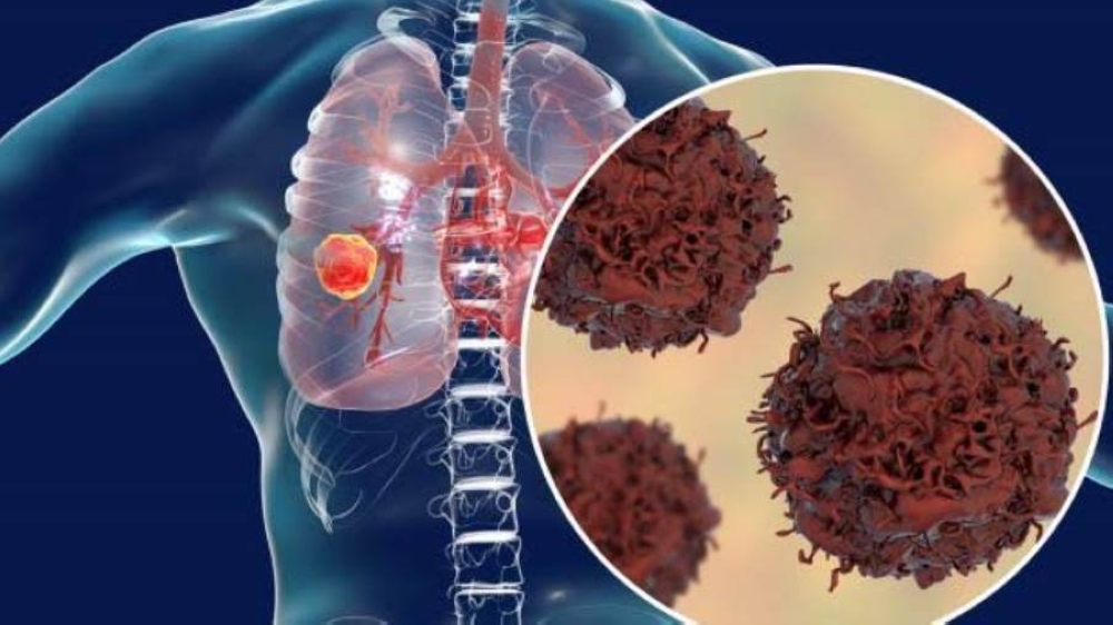 %d8%a3%d9%85%d9%84 %d8%ac%d8%af%d9%8a%d8%af %d9%84%d9%84%d9%85%d9%84%d8%a7%d9%8a%d9%8a%d9%86 %d8%a7%d9%84%d8%af%d9%88%d8%a7%d8%a1 %d8%a7%d9%84%d8%a3%d9%85%d8%b1%d9%8a%d9%83%d9%8a%d8%a9