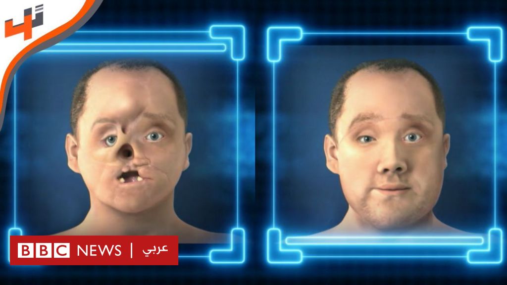 %d8%b2%d8%b1%d8%a7%d8%b9%d8%a9 %d8%a7%d9%84%d9%88%d8%ac%d9%87 %d9%83%d9%8a%d9%81 %d8%aa%d8%b7%d9%88%d9%91%d8%b1%d8%aa %d9%87%d8%b0%d9%87 %d8%a7%d9%84%d8%b9%d9%85%d9%84%d9%8a%d8%a9 %d9%84%d8%aa%d8%b5