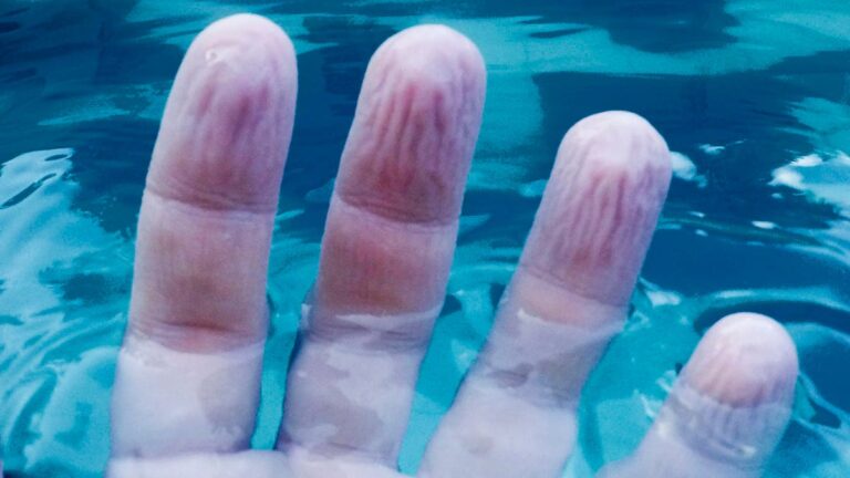 %d8%b9%d9%84%d9%85%d8%a7%d8%a1 %d9%8a%d9%83%d8%aa%d8%b4%d9%81%d9%88%d9%86 %d8%a7%d9%84%d8%b3%d8%a8%d8%a8 %d8%a7%d9%84%d8%ad%d9%82%d9%8a%d9%82%d9%8a %d9%84%d8%aa%d8%ac%d8%b9%d8%af %d8%a7%d9%84%d8%a3