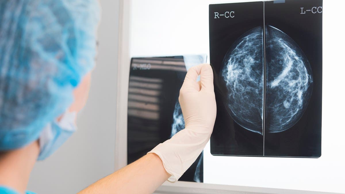 %d8%b9%d9%82%d8%a7%d8%b1 %d9%84%d8%b3%d8%b1%d8%b7%d8%a7%d9%86 %d8%a7%d9%84%d8%ab%d8%af%d9%8a %d9%85%d9%86 %d9%81%d8%a7%d9%8a%d8%b2%d8%b1 %d9%88%d8%a3%d8%b1%d9%81%d9%8a%d9%86%d8%a7%d8%b3 %d9%8a