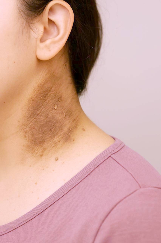 %d8%b9%d9%84%d8%a7%d9%85%d8%a7%d8%aa %d8%ae%d9%81%d9%8a%d8%a9 %d8%aa%d9%86%d8%b0%d8%b1 %d8%a8%d8%a7%d9%84%d8%a5%d8%b5%d8%a7%d8%a8%d8%a9 %d8%a8%d9%85%d9%82%d8%a7%d9%88%d9%85%d8%a9 %d8%a7%d9%84%d8%a3