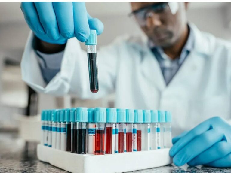 %d8%a7%d8%ae%d8%aa%d8%a8%d8%a7%d8%b1 %d8%ac%d8%af%d9%8a%d8%af %d9%84%d9%84%d8%af%d9%85 %d9%8a%d9%83%d8%b4%d9%81 %d8%a7%d9%84%d8%a5%d8%b5%d8%a7%d8%a8%d8%a9 %d8%a8%d8%a7%d9%84%d8%b3%d8%b1%d8%b7%d8%a7