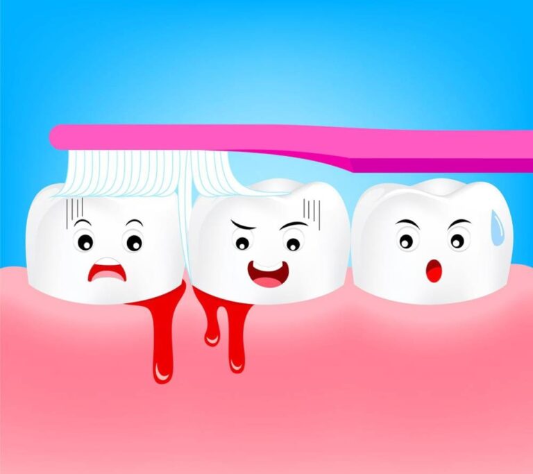 %d9%85%d8%aa%d9%89 %d9%8a%d9%83%d9%88%d9%86 %d9%86%d8%b2%d9%8a%d9%81 %d8%a7%d9%84%d9%84%d8%ab%d8%a9 %d8%b9%d9%84%d8%a7%d9%85%d8%a9 %d8%aa%d8%ad%d8%b0%d9%8a%d8%b1%d8%9f