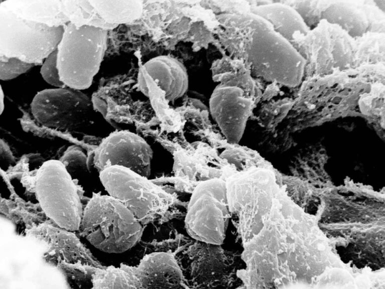 %d8%af%d8%b1%d8%a7%d8%b3%d8%a9 %d8%a3%d9%82%d8%af%d9%85 %d8%a3%d9%85%d8%b1%d8%a7%d8%b6 %d8%a7%d9%84%d8%a8%d8%b4%d8%b1%d9%8a%d8%a9 %d9%85%d9%86%d8%b0 37 %d8%a3%d9%84%d9%81 %d8%b9%d8%a7%d9%85