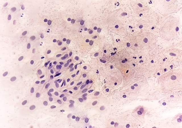 58dcb47a 7a35 4ce5 9f1d 9f0392a00bf1