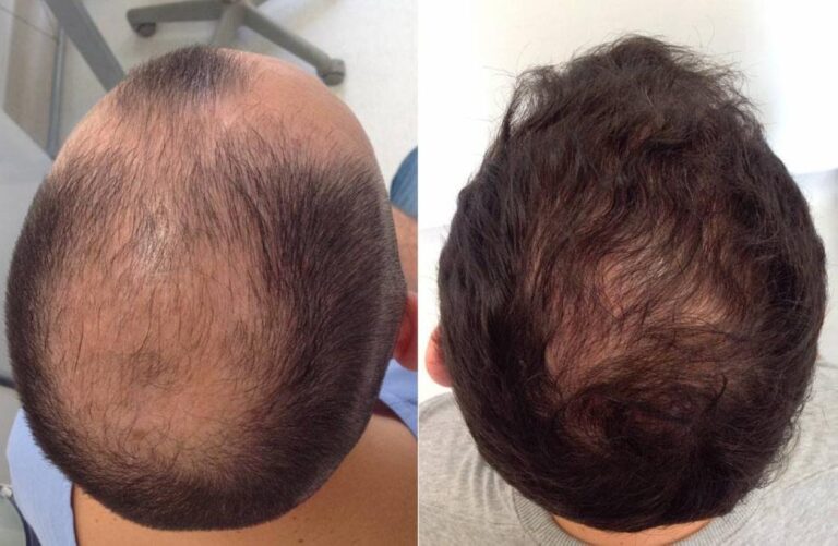 C8f52e16 7520 4c2c ada6 e3531f6cdc13 file.jpg