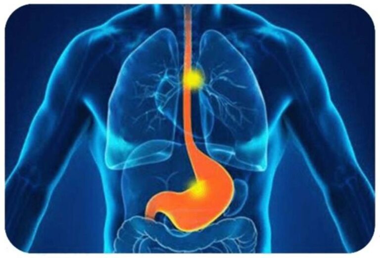 Eef82c5e 937b 4f97 8683 b8aa3777e451 file.jpg