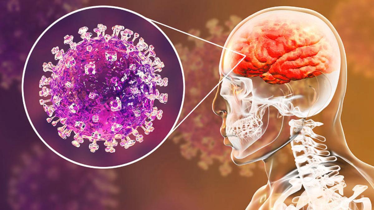 461dad3f 366e 4dd0 b62f c6570884ab43 file.jpg