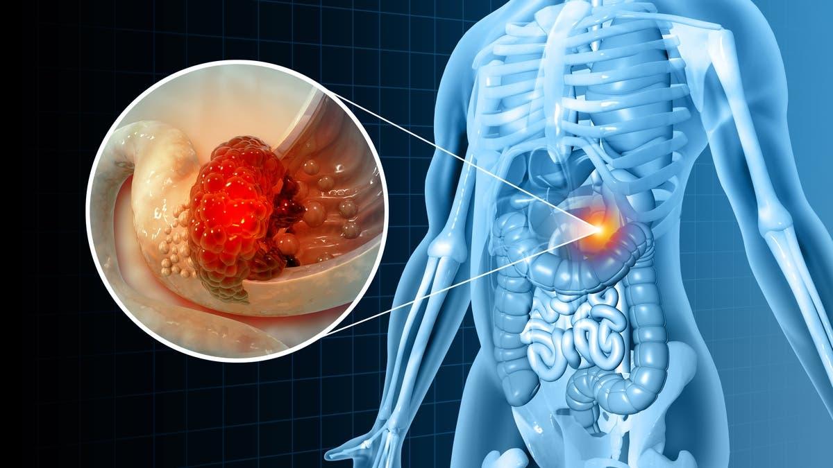 C5f30e7f ecc8 4fa1 bdc1 0fa80585dad1 file.jpg