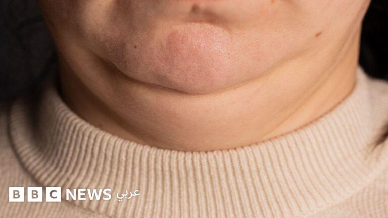 40df6278 5fb8 4023 a101 2c2a1f424bc5 file.jpg