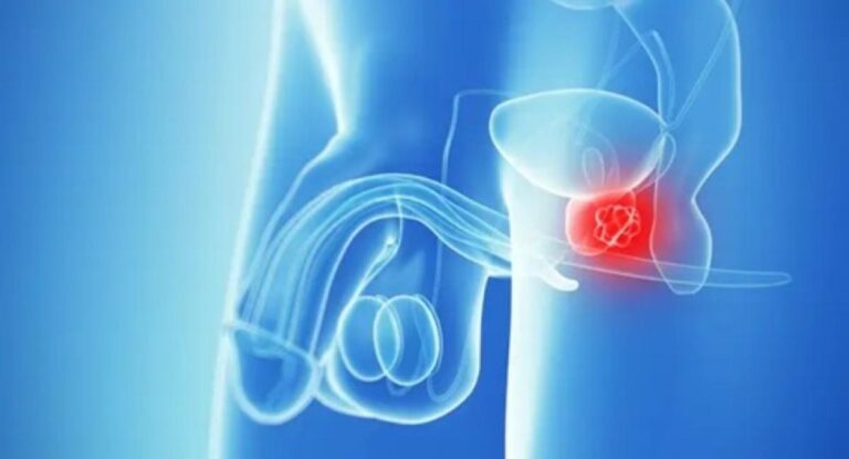 5b2b8def be98 4d33 810e 3fd2c769b637 file.jpg