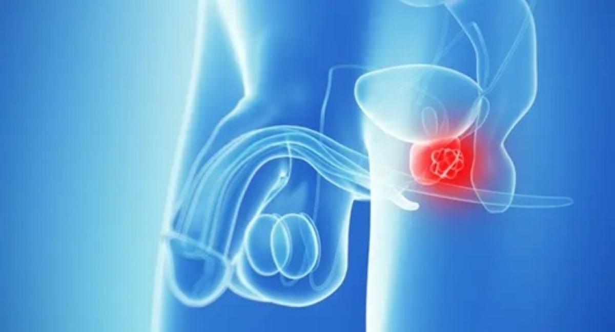 5b2b8def be98 4d33 810e 3fd2c769b637 file.jpg