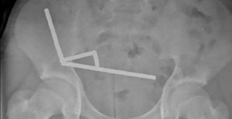 73793b6f c9a7 434e 8eba 40a176635ed1 file.jpg