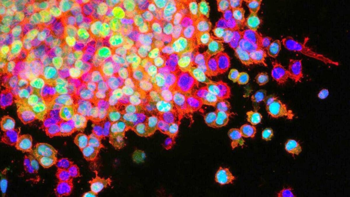 علاج ضوئي يقضي على الخلايا السرطانية بدقة