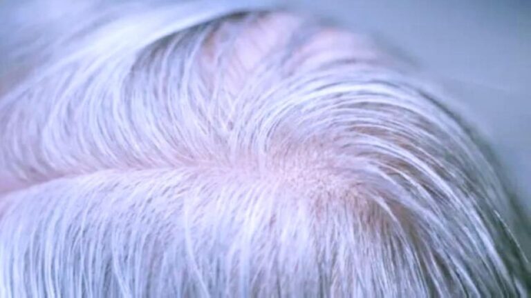 98ee47c8 6f37 485b ae59 3523685d5cf4 file.jpg