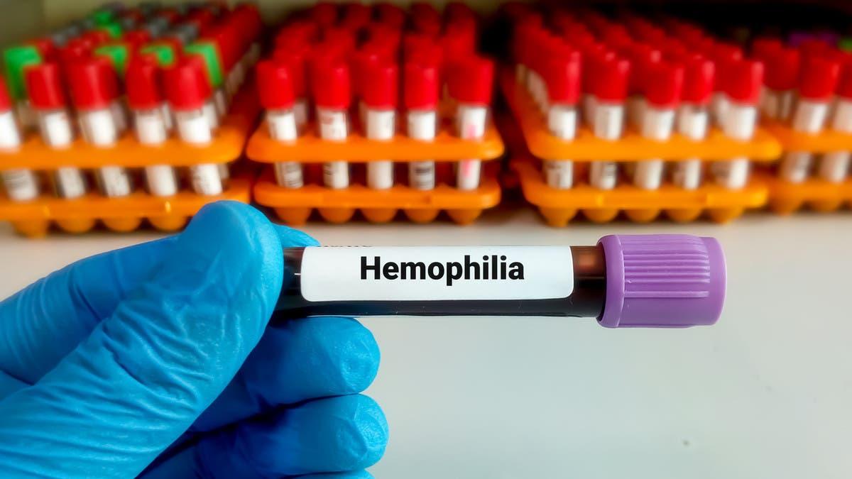 A3dd1af4 8921 4c44 8815 bd092e943862 file.jpg