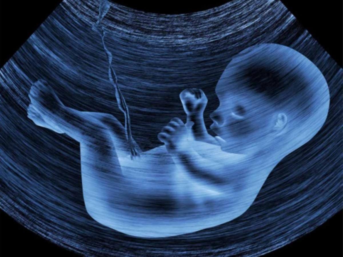 Cbc94c76 f303 48f6 a1a1 d61e123fb72c file.jpg