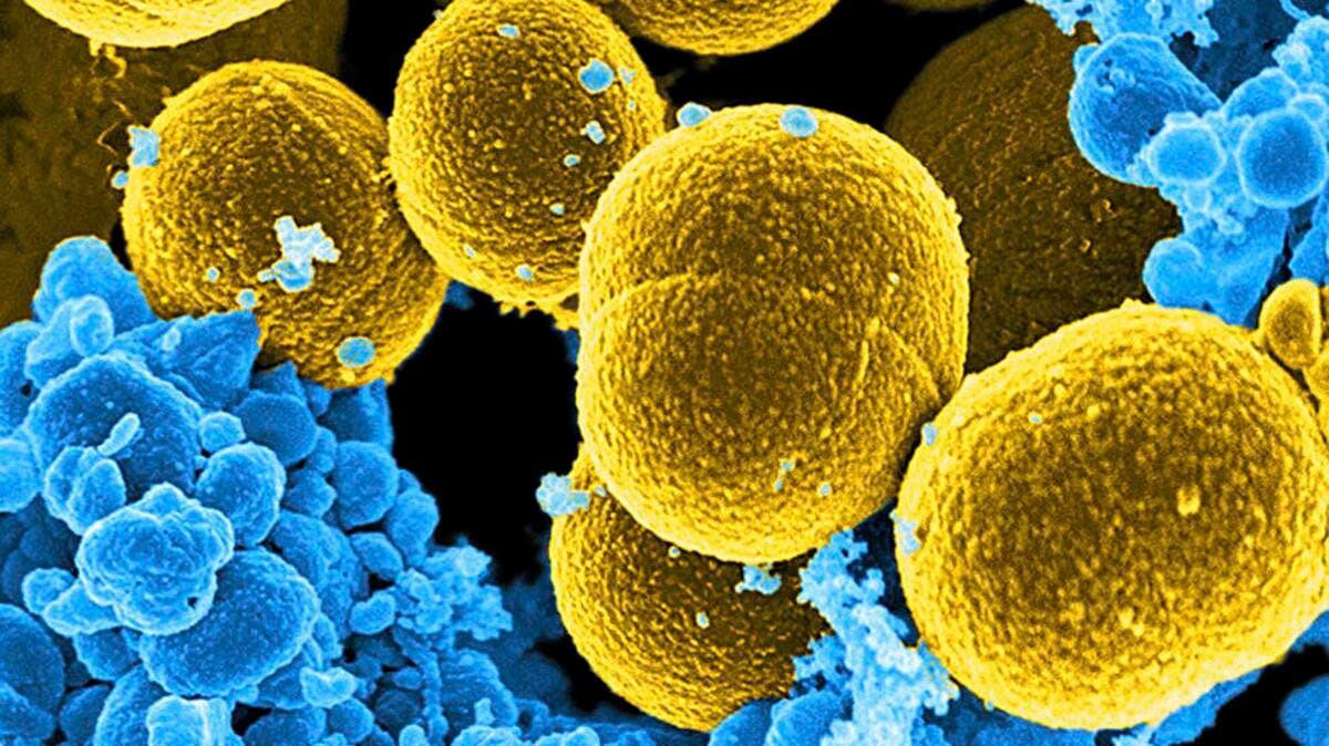 فيروسات “ملتهمة للبكتيريا” تساعد على علاج أخطر أنواع العدوى البكتيرية