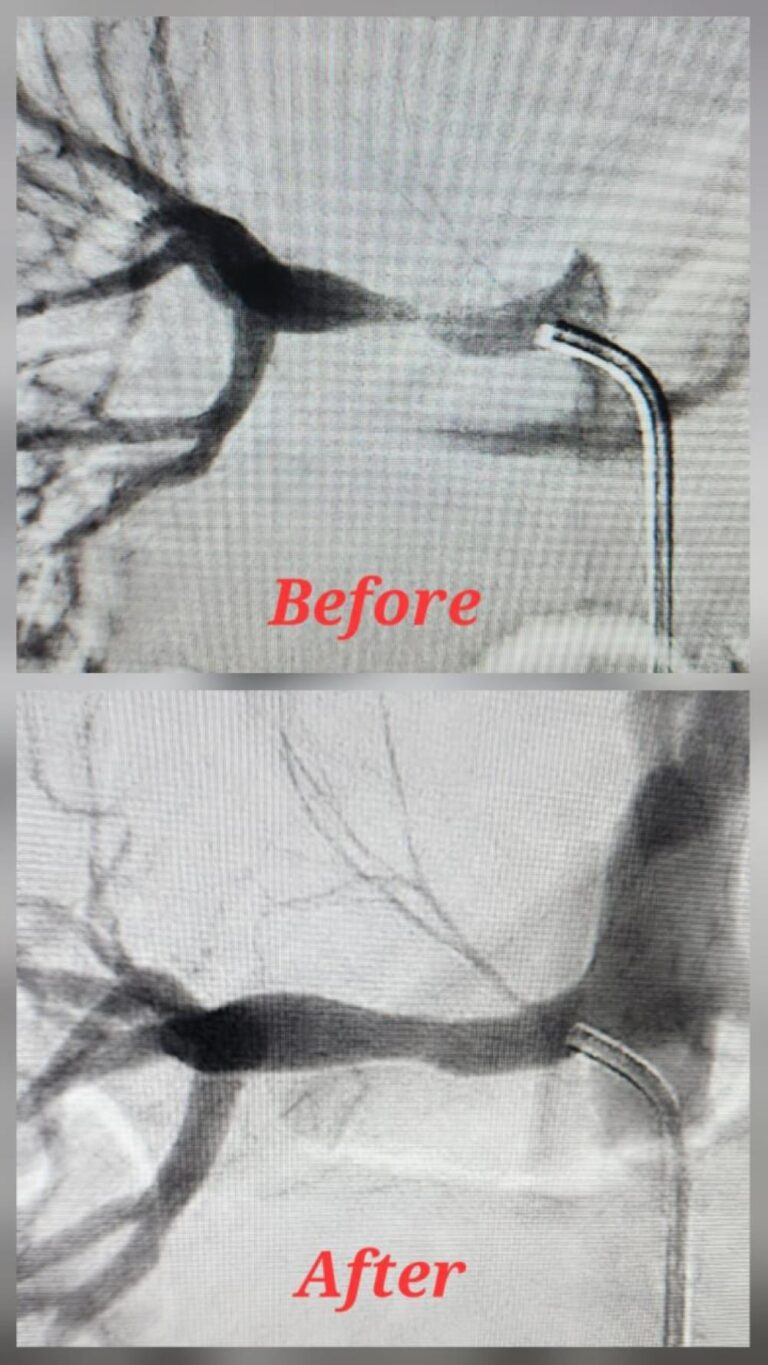 0b4d6424 3253 40e5 8a55 18a13bcca0e0 file.jpg