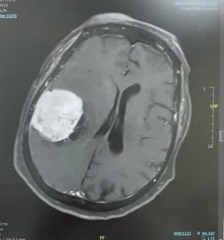 6e152682 faf5 4c3f ac25 b67e30f493fe file.jpg