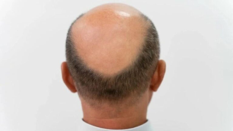 A7e9304d 3d09 4641 99af 3f1fa55ea141 file.jpg