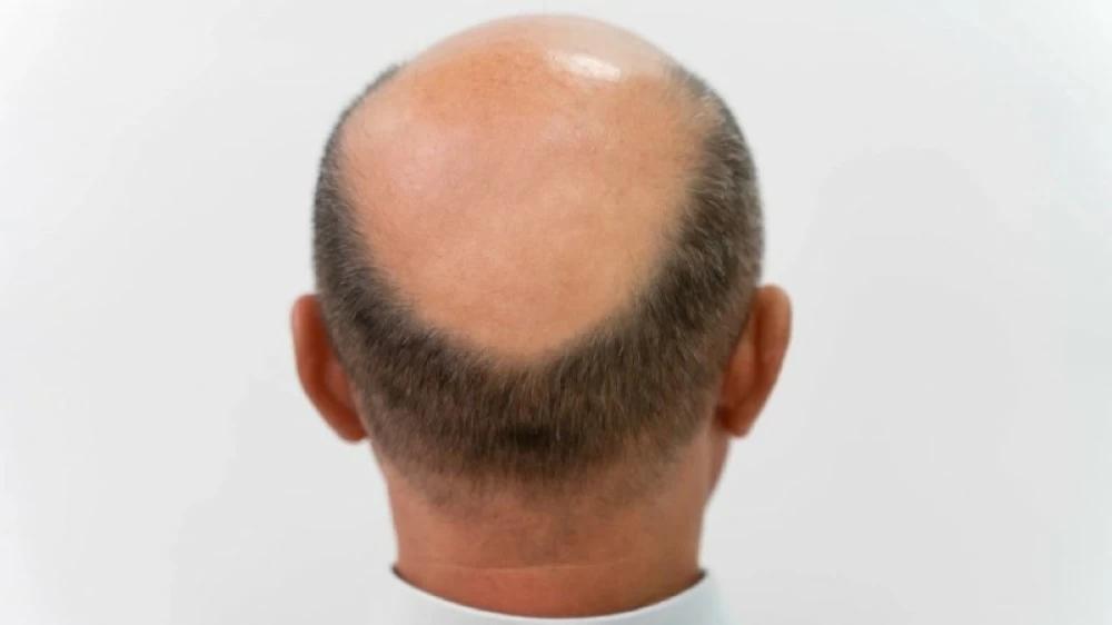 A7e9304d 3d09 4641 99af 3f1fa55ea141 file.jpg