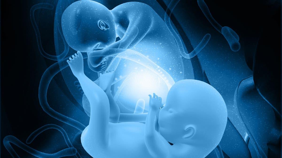 E1af2311 2045 45fc 8fae 5556a36522e5 file.jpg