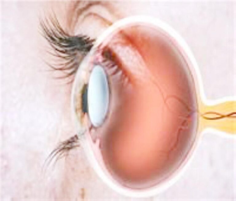 Ea626dde 5002 458d b68d d1cb1f1b24cf file.jpg