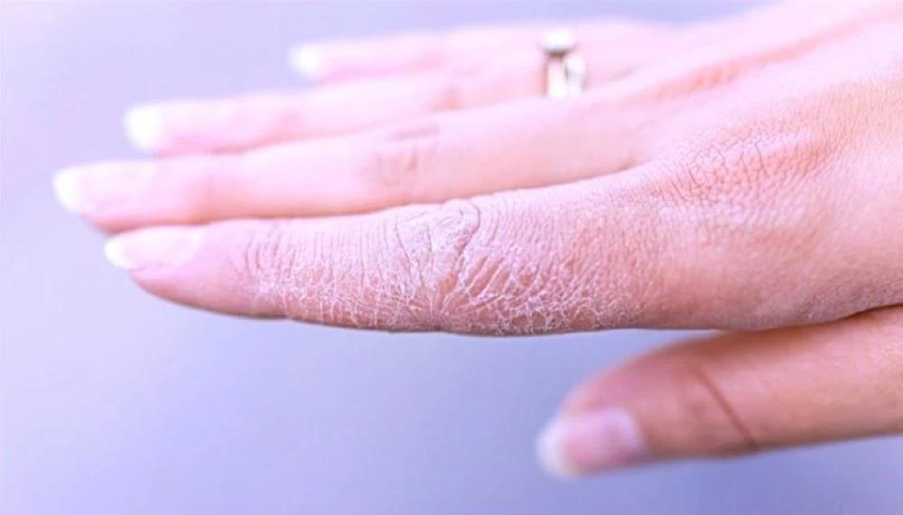 6f2695be 9589 4d62 974a 70d06f7b93ba file.jpg