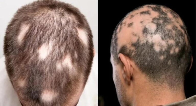 00a5cde5 aca2 488c 93c7 769dbd829870 file.jpg