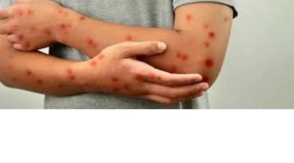 2ea574e7 0944 4adb b2d9 07ac3b11521f file.jpg