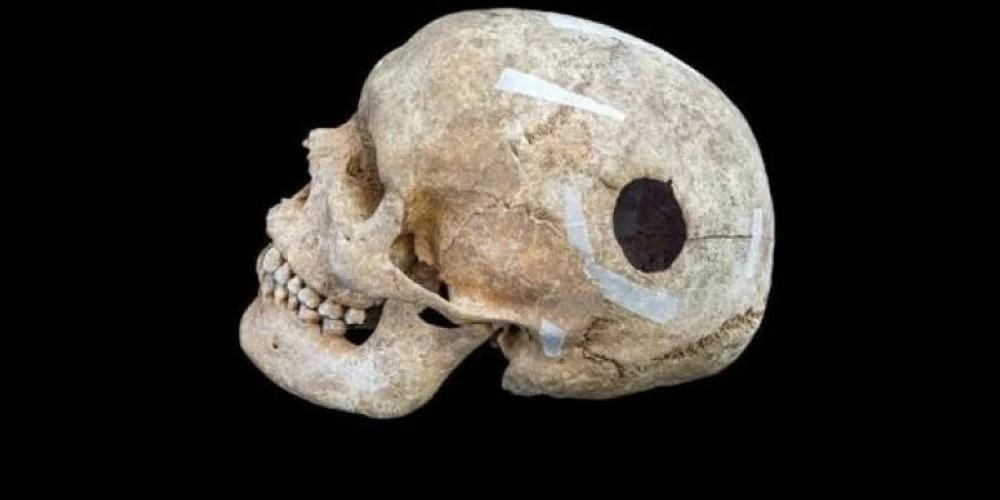 07fda6d2 afb9 4f5e 8fbb c53f7c89779e file.jpg