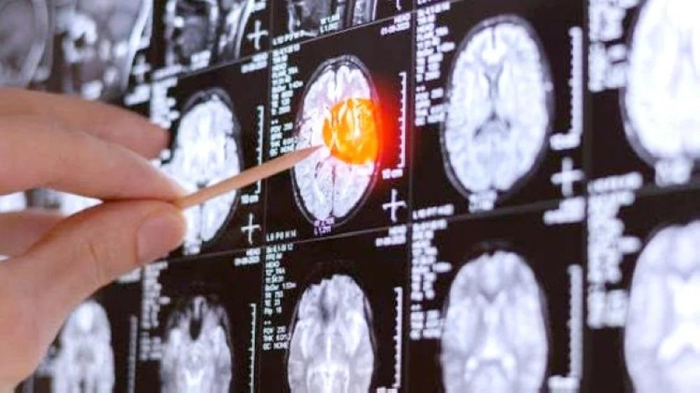 74434d03 37c6 4e2f b393 826fb821a5fe file.jpg