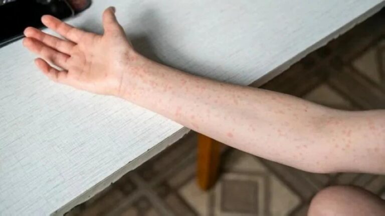 99dab898 1640 459f 89a3 70755102ee0a file.jpg