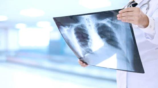 2e077f3f aa4e 47eb 9943 3e1f32b021f7 file.jpg