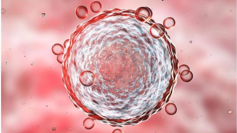 E5bf1b5c 296c 4247 9b06 cda90876ca0f file.jpg