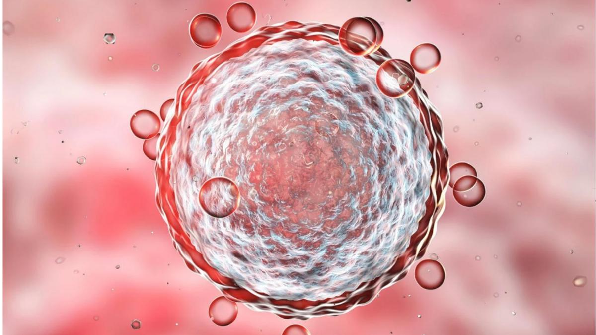 E5bf1b5c 296c 4247 9b06 cda90876ca0f file.jpg