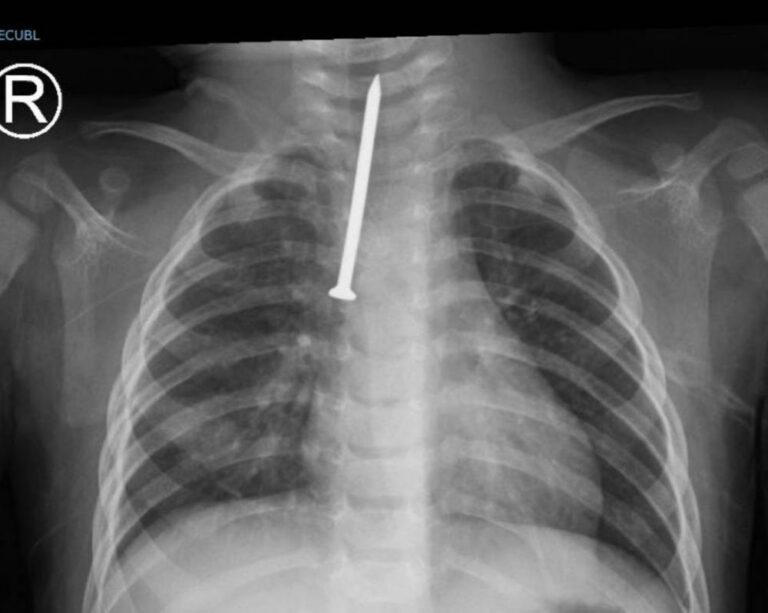 F312a6d4 daa2 4945 8360 6e6d20ac371c file.jpg