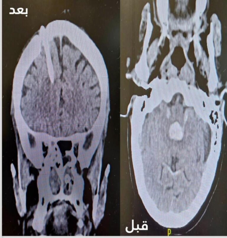 6e6dd972 ac86 47cf 8e44 016685f183c8 file.jpg